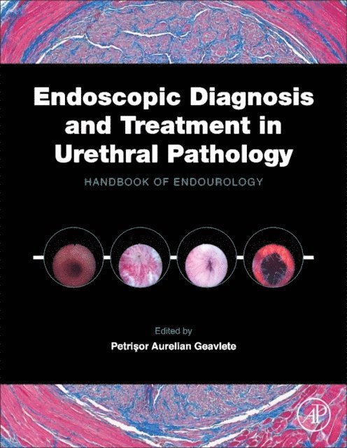 Petrisor Aurelian Geavlete - Endoscopic Diagnosis and Treatment in Urethral Pathology, E-bok