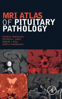 Kevin M. Pantalone, Stephen E. Jones, Robert J. Weil, Amir H. Hamrahian - MRI Atlas of Pituitary Pathology, Inbunden