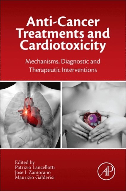 Maurizio Galderisi, Jose L Zamorano, Patrizio Lancellotti - Anticancer Treatments and Cardiotoxicity, E-bok