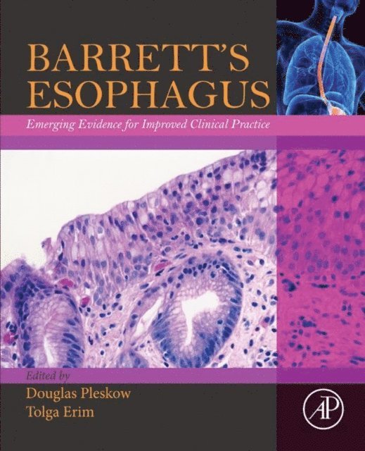 Tolga Erim, Douglas Pleskow - Barrett's Esophagus, E-bok. Tillgänglighet: Lägg i varukorg
