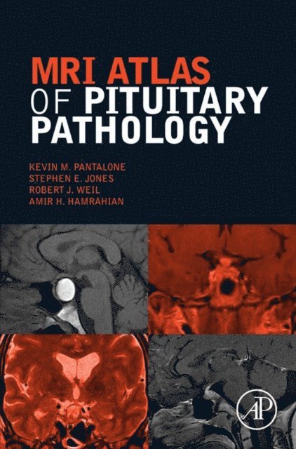 Amir H. Hamrahian, Robert J. Weil, Stephen E. Jones, Kevin M. Pantalone - MRI Atlas of Pituitary Pathology, E-bok