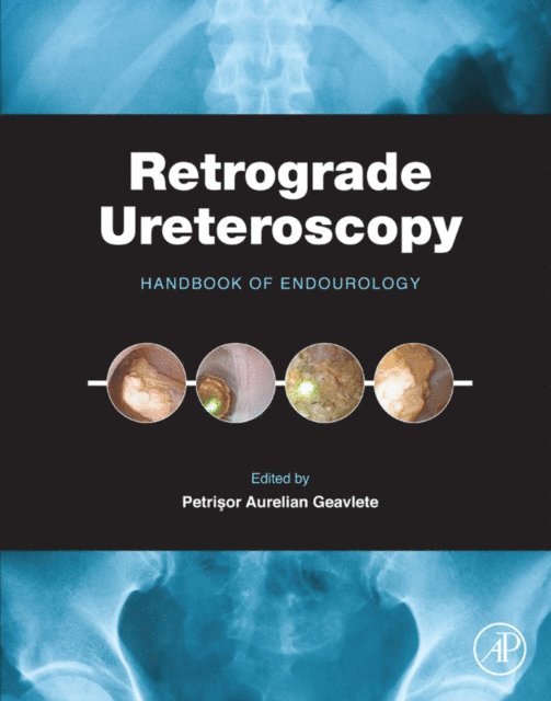 Petrisor Aurelian Geavlete - Retrograde Ureteroscopy, E-bok