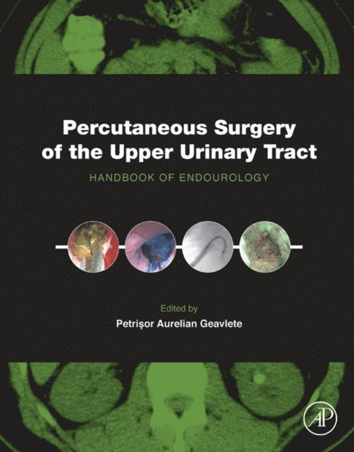 Petrisor Aurelian Geavlete - Percutaneous Surgery of the Upper Urinary Tract, E-bok