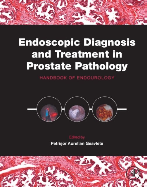 Petrisor Aurelian Geavlete - Endoscopic Diagnosis and Treatment in Prostate Pathology, E-bok