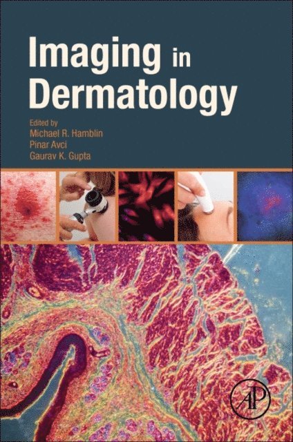 Gaurav K Gupta, Pinar Avci, Michael R. Hamblin - Imaging in Dermatology, E-bok