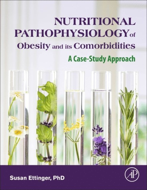Susan Ettinger - Nutritional Pathophysiology of Obesity and its Comorbidities, E-bok