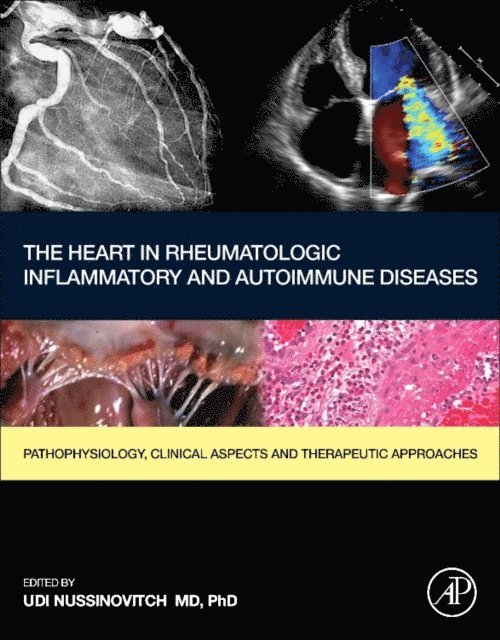 Udi Nussinovitch - Heart in Rheumatic, Autoimmune and Inflammatory Diseases, E-bok