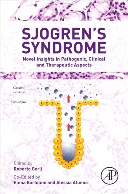 Roberto Gerli, Elena Bartoloni, Alessia Alunno - Sjogren's Syndrome, E-bok