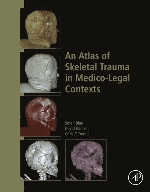 Chris O'Donnell, David Ranson, Soren Blau - Atlas of Skeletal Trauma in Medico-Legal Contexts, E-bok
