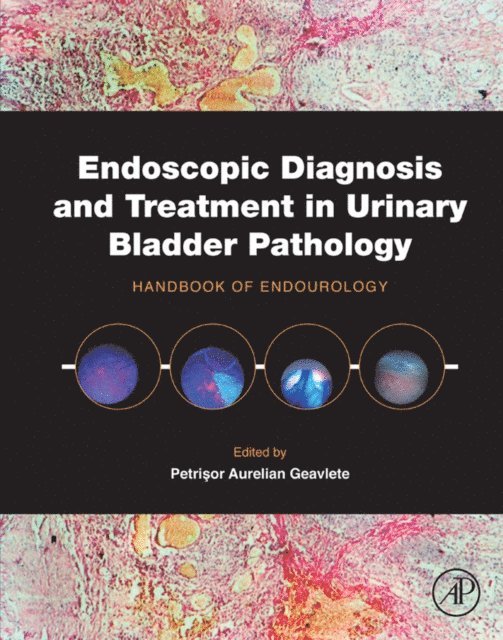 Petrisor Aurelian Geavlete - Endoscopic Diagnosis and Treatment in Urinary Bladder Pathology, E-bok