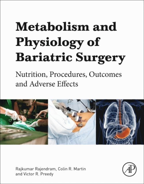 Colin R. Martin, Rajkumar Rajendram, Victor R. Preedy - Metabolism and Pathophysiology of Bariatric Surgery, E-bok