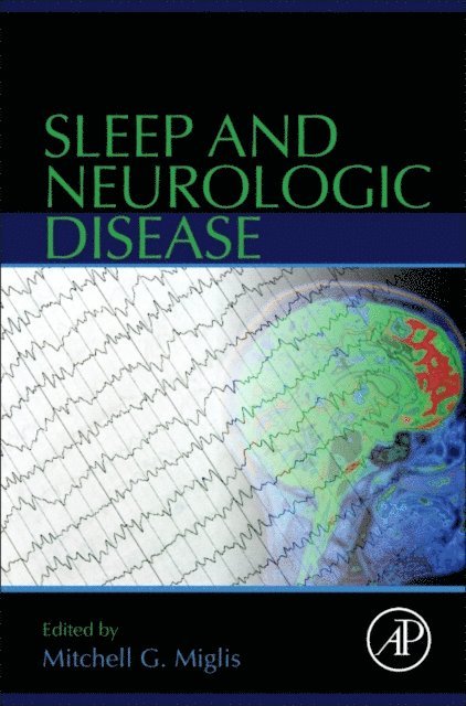 Mitchell G. Miglis - Sleep and Neurologic Disease, E-bok. Tillgänglighet: Lägg i varukorg