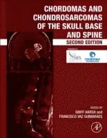 Francisco Vaz-Guimaraes, Griffith R. Harsh IV - Chordomas and Chondrosarcomas of the Skull Base and Spine, E-bok. Tillgänglighet: Lägg i varukorg