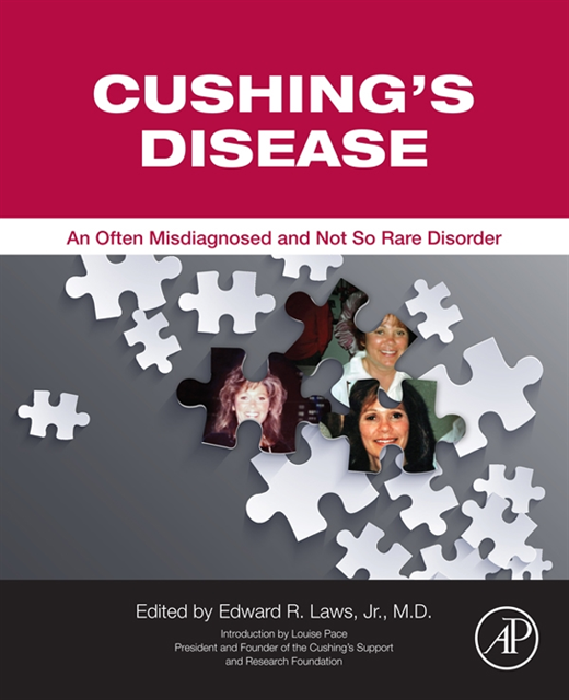 Louise Pace, Edward R. Laws Jr - Cushing's Disease, E-bok