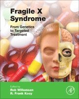 Rob Willemsen, Frank Kooy - Fragile X Syndrome, Inbunden