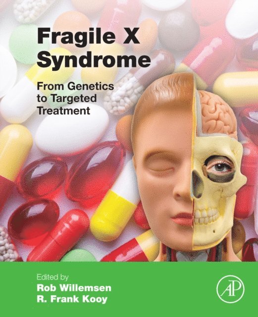 Frank Kooy, Rob Willemsen - Fragile X Syndrome, E-bok