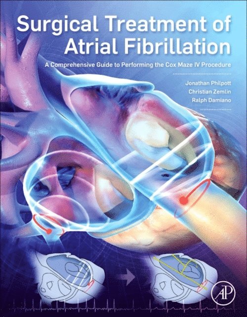 Ralph J. Damiano, Christian Zemlin, Jonathan Philpott - Surgical Treatment of Atrial Fibrillation, E-bok