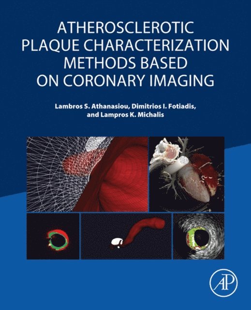 Lampros K Michalis, Dimitrios I Fotiadis, Lambros S Athanasiou - Atherosclerotic Plaque Characterization Methods Based on Coronary Imaging, E-bok