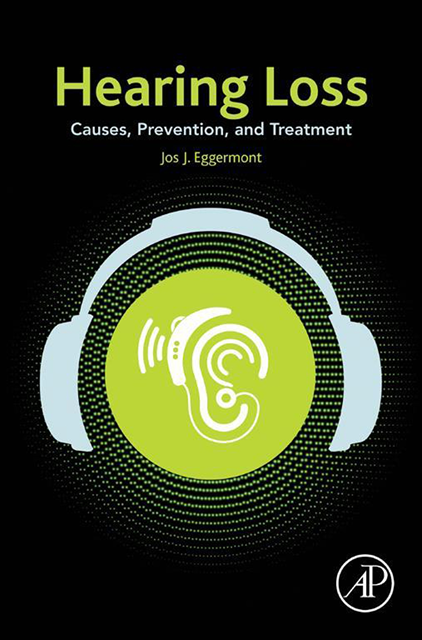 Jos J. Eggermont - Hearing Loss, E-bok