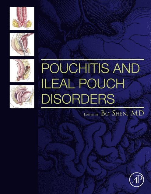 Bo Shen - Pouchitis and Ileal Pouch Disorders, E-bok