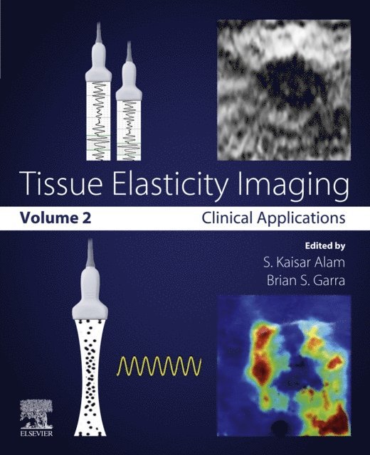 Brian S. Garra, S. Kaisar Alam - Tissue Elasticity Imaging, E-bok