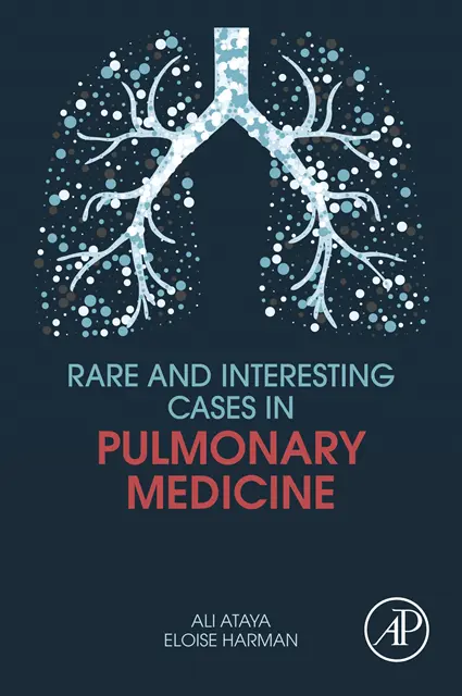 Eloise Harman, Ali Ataya - Rare and Interesting Cases in Pulmonary Medicine, E-bok. Tillgänglighet: Lägg i varukorg