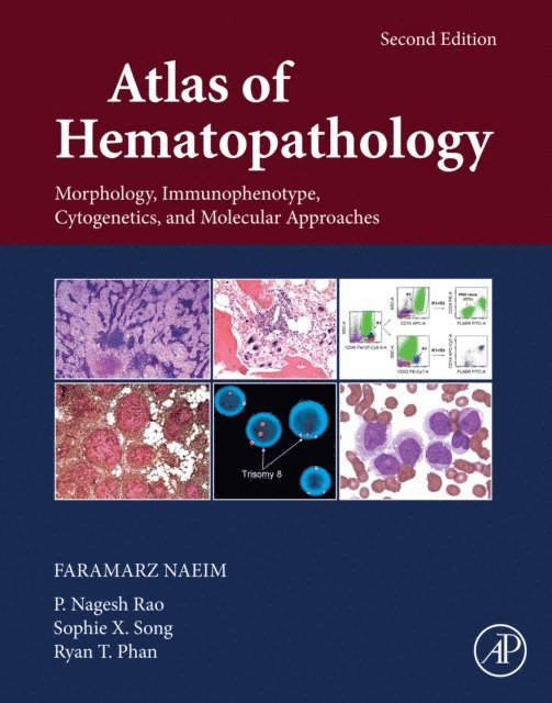 Ryan T. Phan, Sophie X. Song, P. Nagesh Rao, Faramarz Naeim - Atlas of Hematopathology, E-bok