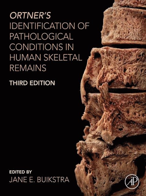 Jane E. Buikstra - Ortner's Identification of Pathological Conditions in Human Skeletal Remains, E-bok