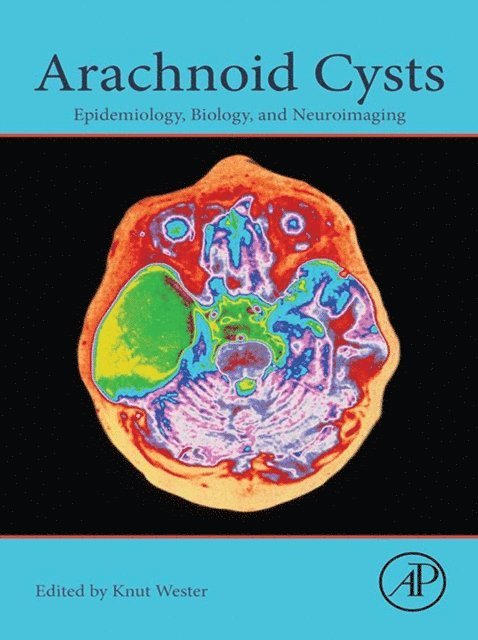 Knut Wester - Arachnoid Cysts, E-bok