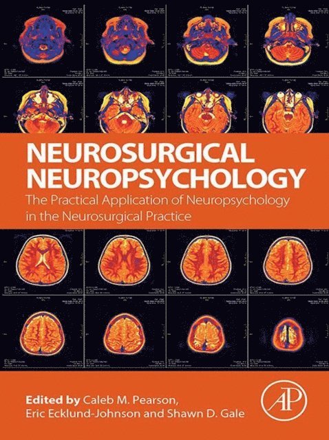 Shawn D. Gale, Eric Ecklund-Johnson, Caleb M. Pearson - Neurosurgical Neuropsychology, E-bok