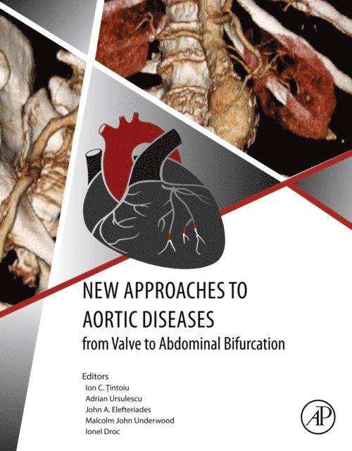 Ionel Droc, Malcolm John Underwood, Adrian Ursulescu, John A. Elefteriades, Ion C. Tintoiu - New Approaches to Aortic Diseases from Valve to Abdominal Bifurcation, E-bok