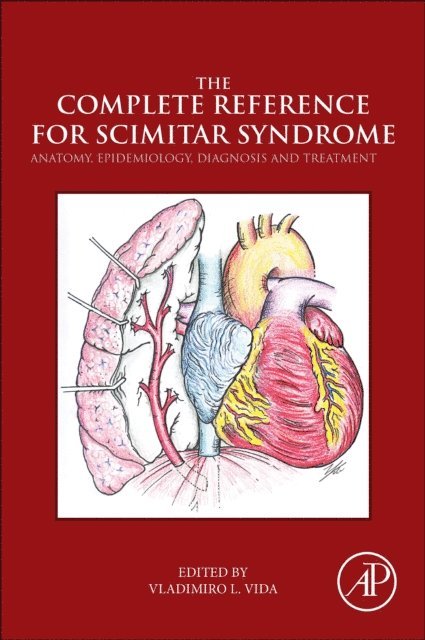 Vladimiro Vida - Complete Reference for Scimitar Syndrome, E-bok