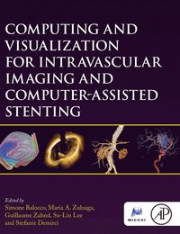 Computing and Visualization for Intravascular Imaging and Computer-Assisted Stenting