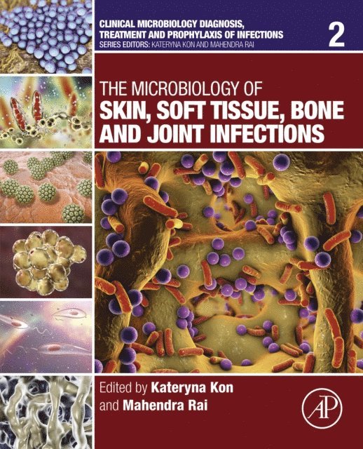 Mahendra Rai, Kateryna Kon - Microbiology of Skin, Soft Tissue, Bone and Joint Infections, E-bok