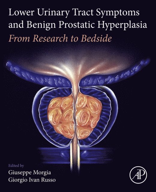 Giorgio Ivan Russo, Giuseppe Morgia - Lower Urinary Tract Symptoms and Benign Prostatic Hyperplasia, E-bok