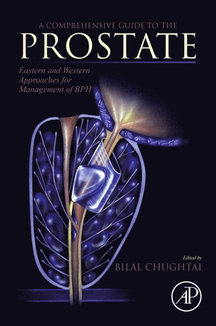 Bilal Chughtai - Comprehensive Guide to the Prostate, E-bok