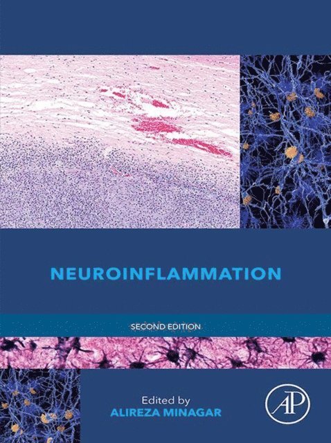 Alireza Minagar - Neuroinflammation, E-bok
