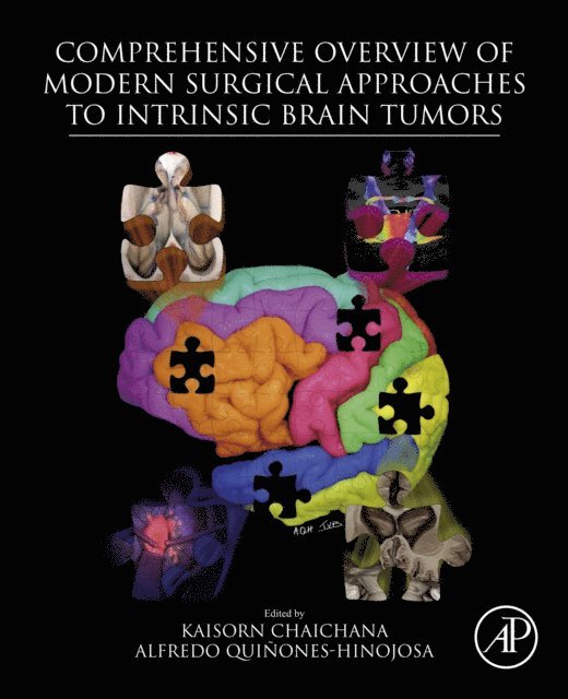 Alfredo Quinones-Hinojosa, Kaisorn Chaichana - Comprehensive Overview of Modern Surgical Approaches to Intrinsic Brain Tumors, E-bok
