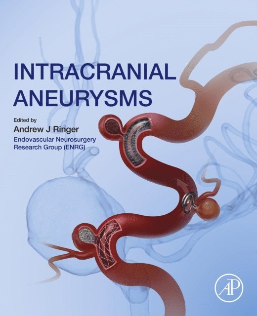 Andrew J. Ringer - Intracranial Aneurysms, E-bok