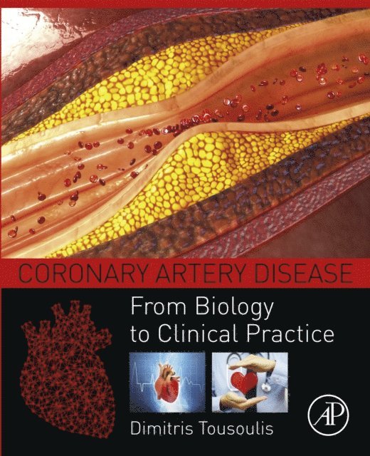 Dimitris Tousoulis - Coronary Artery Disease, E-bok