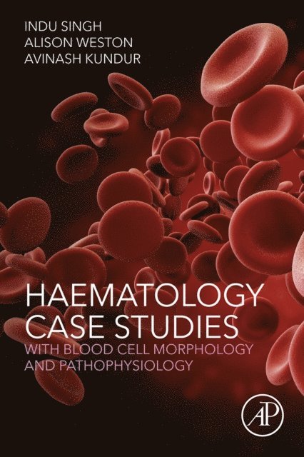 Gasim Dobie, Avinash Kundur, Alison Weston, Indu Singh - Haematology Case Studies with Blood Cell Morphology and Pathophysiology, E-bok