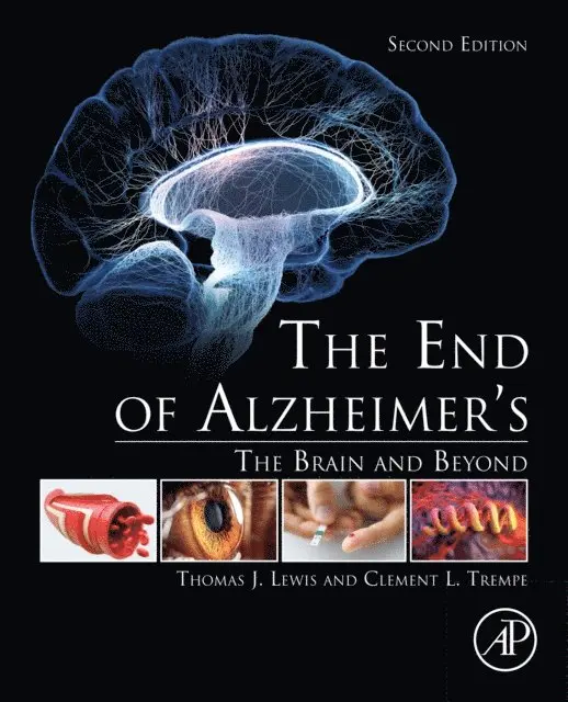 Clement L. Trempe, Thomas J. Lewis - End of Alzheimer's, E-bok. Tillgänglighet: Lägg i varukorg