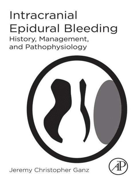 Jeremy Christopher Ganz - Intracranial Epidural Bleeding, E-bok