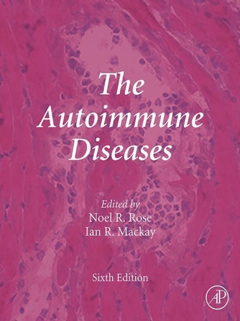 George C. Tsokos, M. Eric Gershwin - Autoimmune Diseases, E-bok
