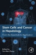 Stem Cells and Cancer in Hepatology