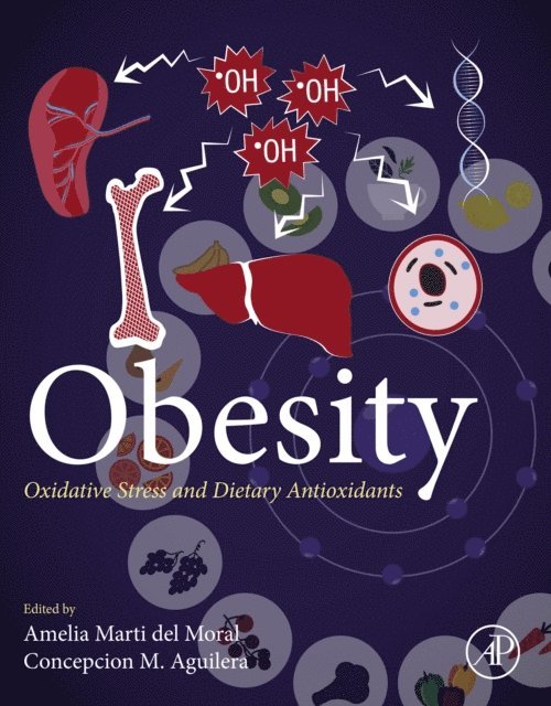 Concepcion M. Aguilera, Amelia Marti del Moral - Obesity, E-bok