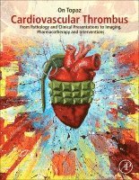 On Topaz - Cardiovascular Thrombus, Inbunden. Tillgänglighet: Lägg i varukorg