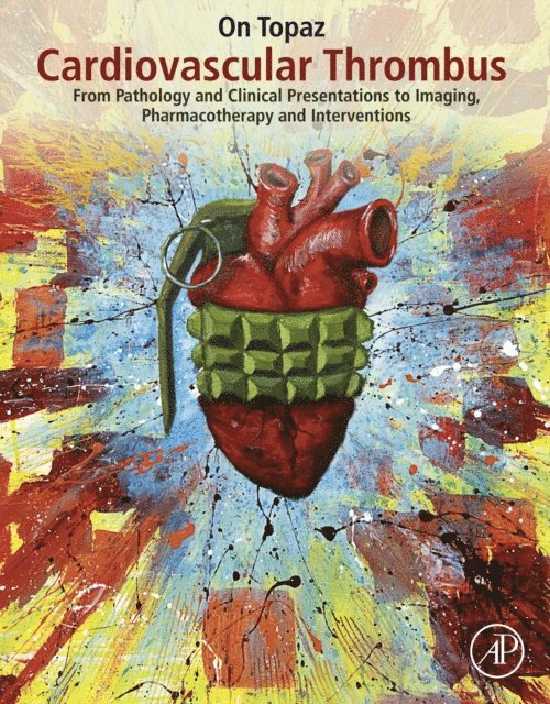 On Topaz - Cardiovascular Thrombus, E-bok. Tillgänglighet: Lägg i varukorg