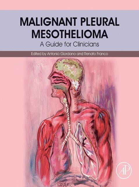 Renato Franco, Antonio Giordano - Malignant Pleural Mesothelioma, E-bok