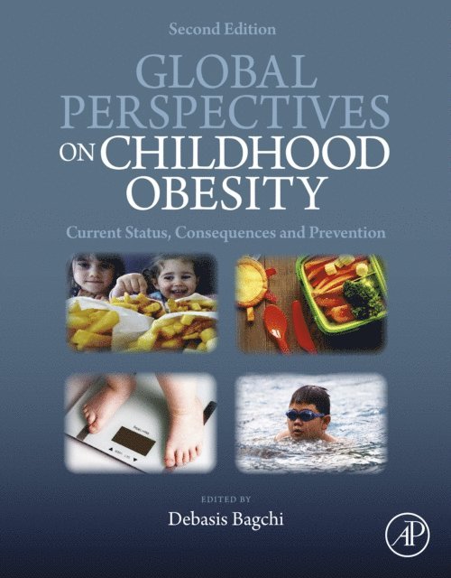 Debasis Bagchi - Global Perspectives on Childhood Obesity, E-bok